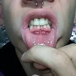 poxerk