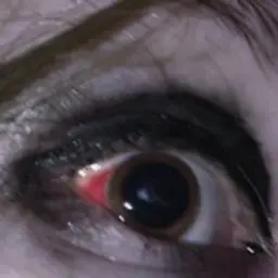 cyht