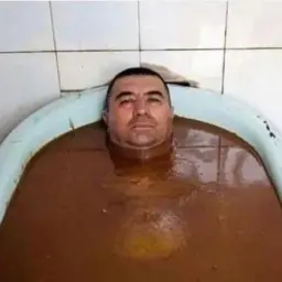 V0vaVist