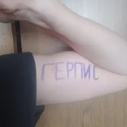 герпис