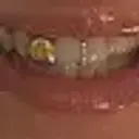 eternalshynee